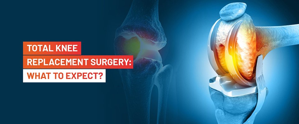 Total Knee Replacement Arthroplasty Explained: Causes, Recovery & Long-Term Success