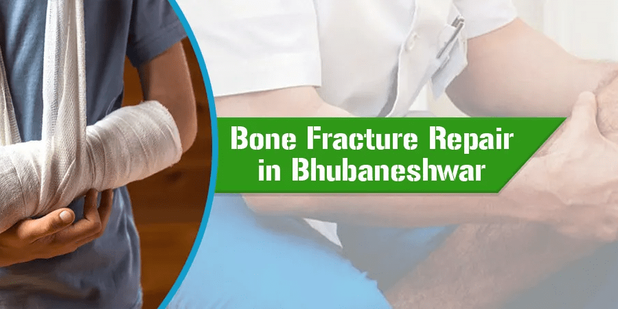 What are bone fractures: Types and Treatment in Bhubaneswar