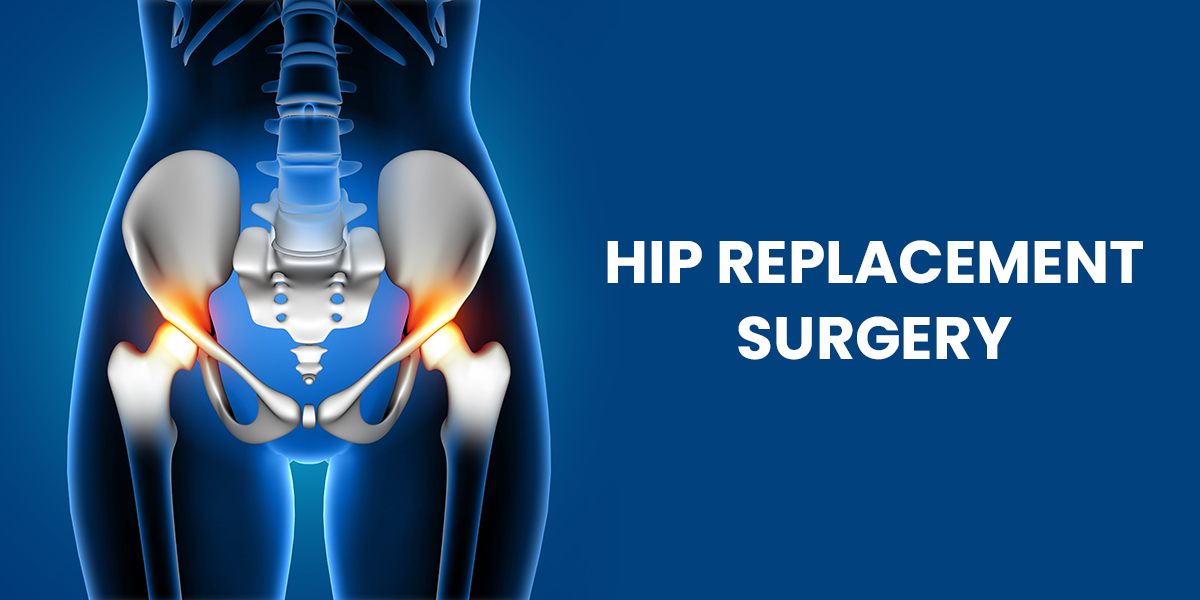 Is A Hip Reconstruction The Same As a Hip Replacement?