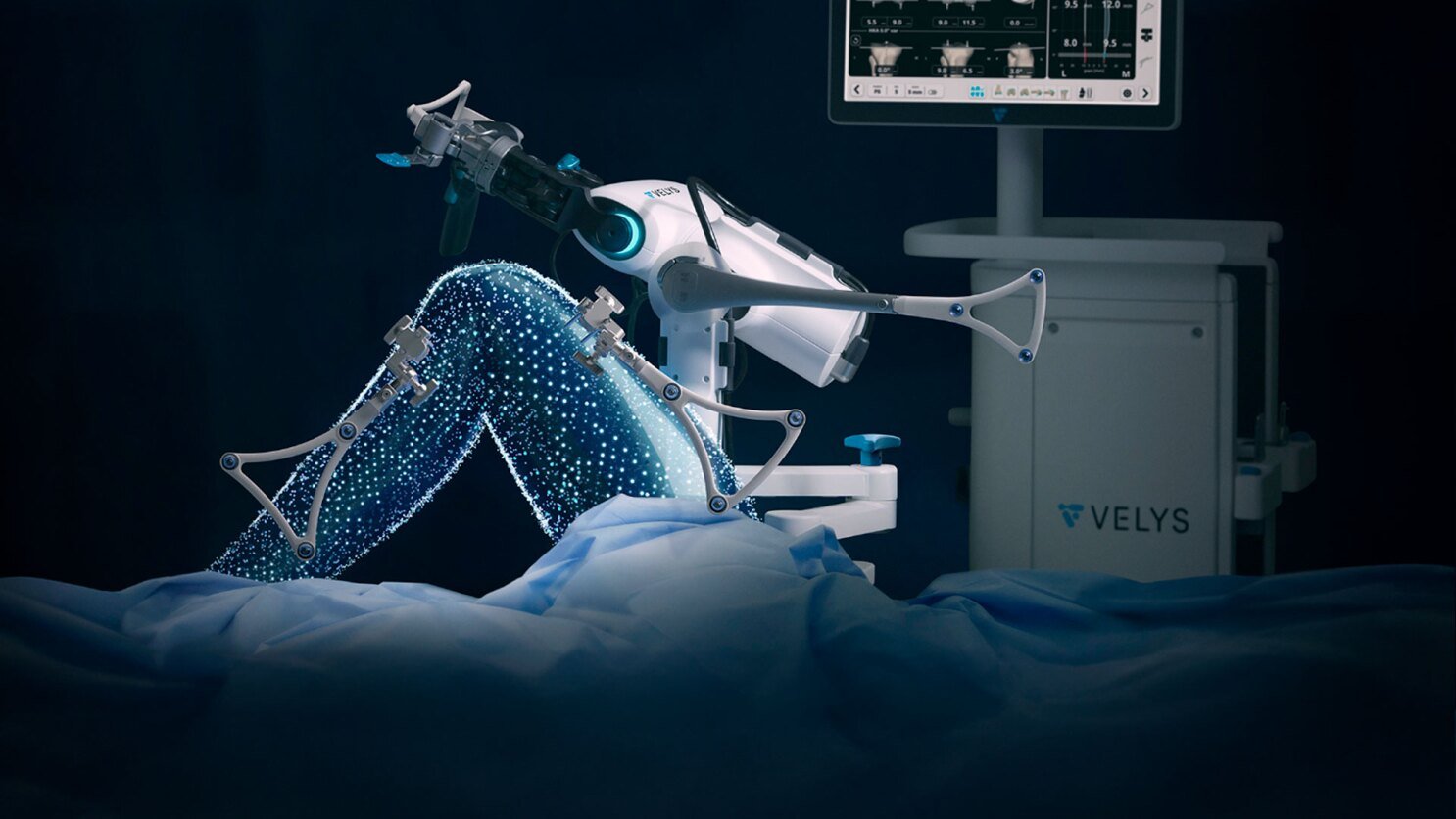 Total Knee Replacement Robotic Surgery — Dr. Devasis Sarangi